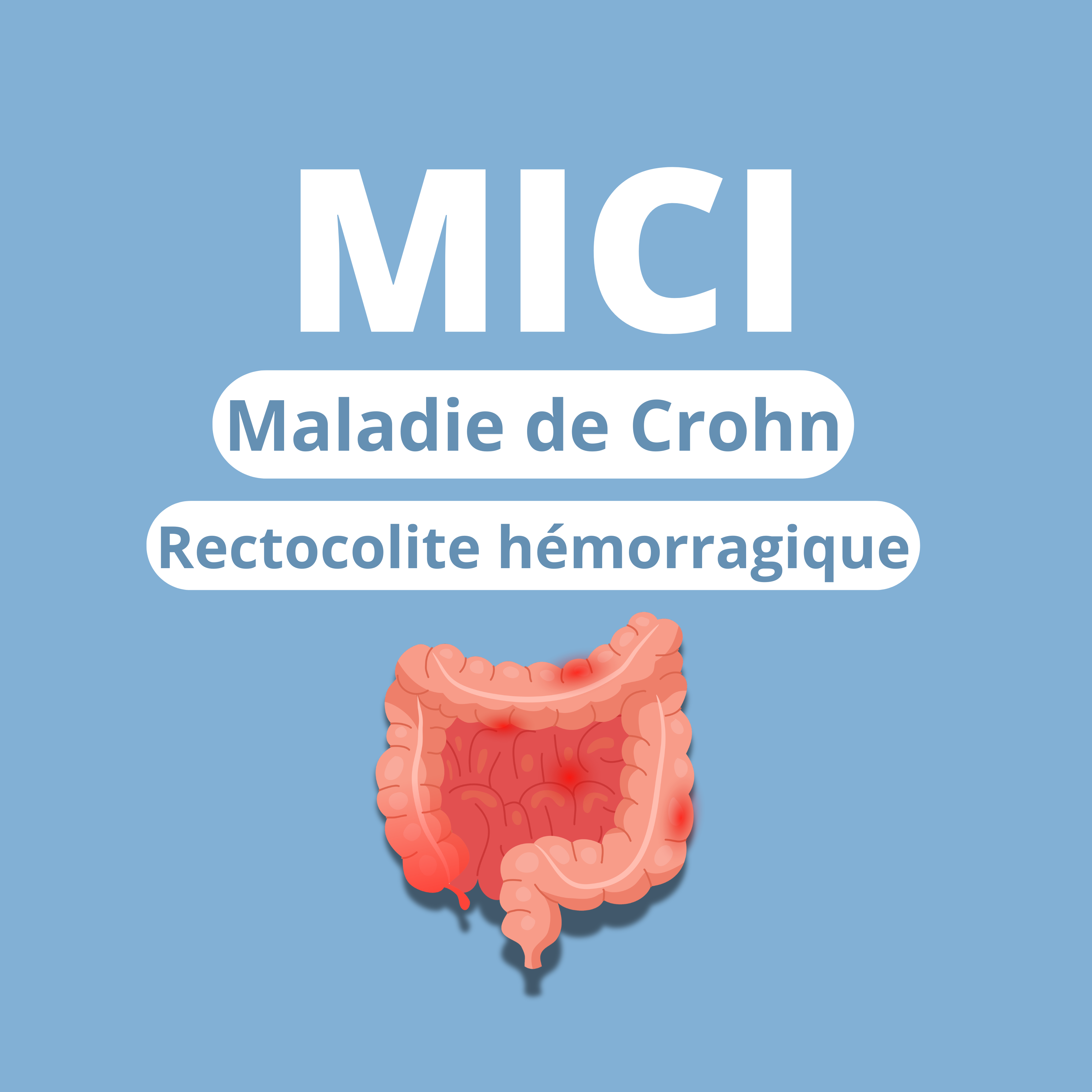 MICI Crohn rectocolite intestin inflammation maladie intestinale