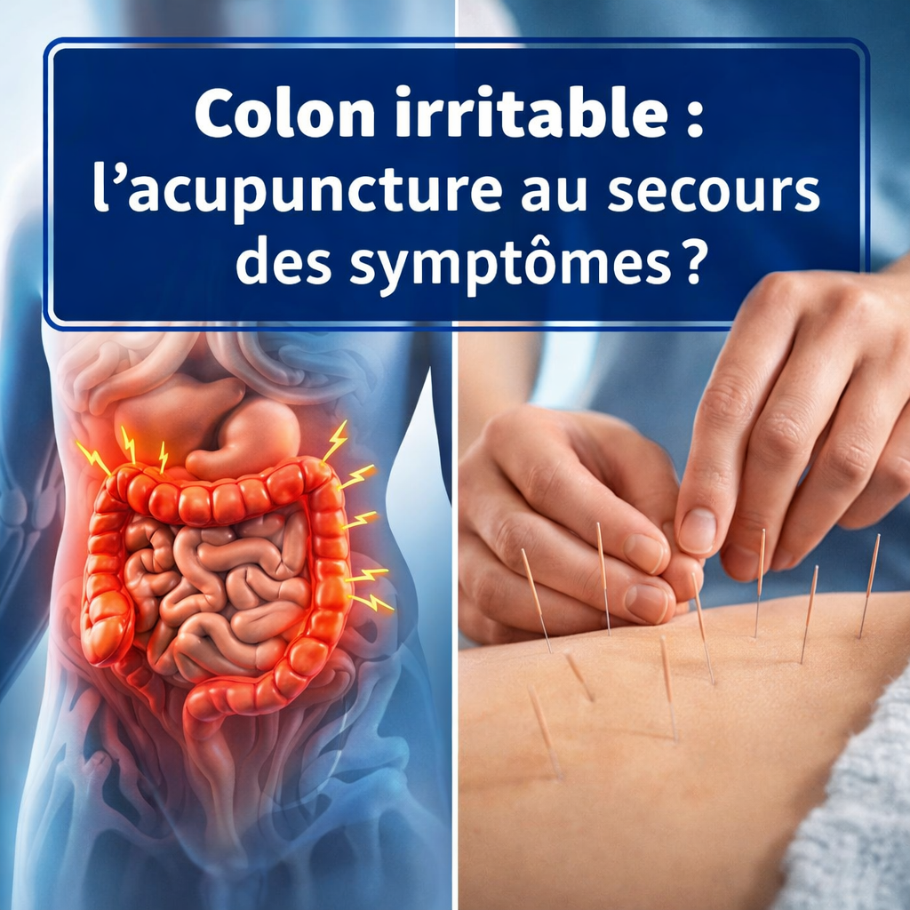 Colon irritable : l’acupuncture au secours des symptômes ?